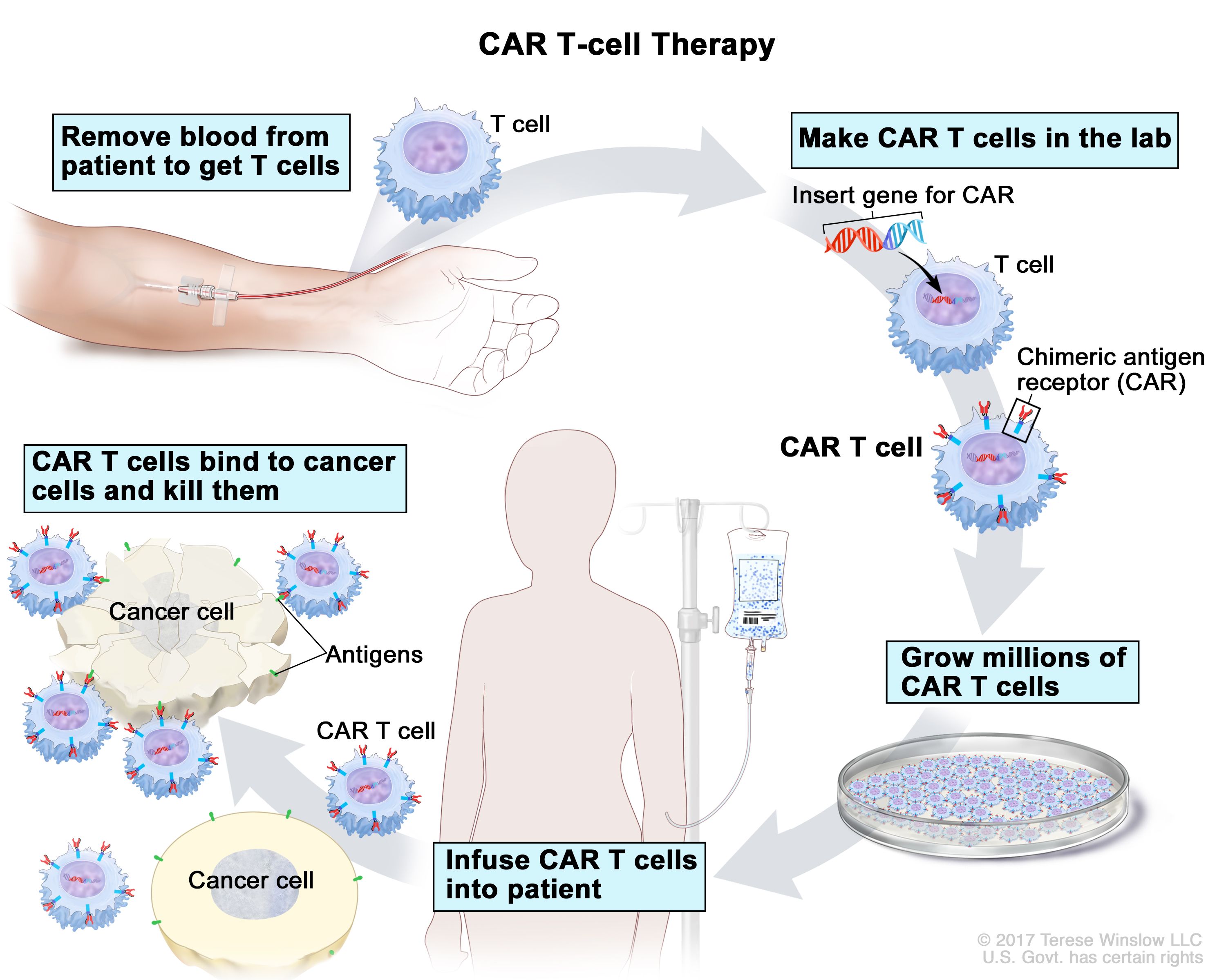 CAR-T.jpg